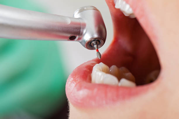 Best Emergency Treatment for Oral Infections in Darlington, SC
